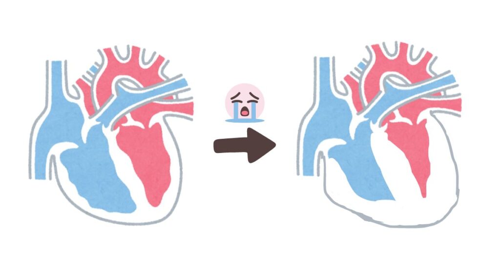 Bệnh cơ tim và lợi ích không ngờ của chế độ ăn chay
