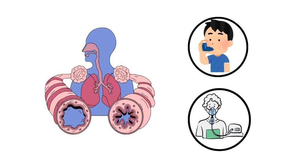 Khám phá cách dinh dưỡng thực vật giúp cải thiện bệnh hen suyễn