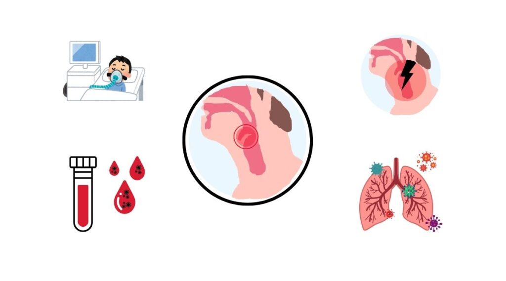 Giảm nguy cơ viêm nắp thanh quản với chế độ ăn chay