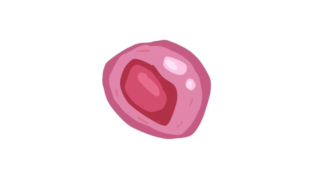 Giải pháp tự nhiên cho bệnh Chlamydia