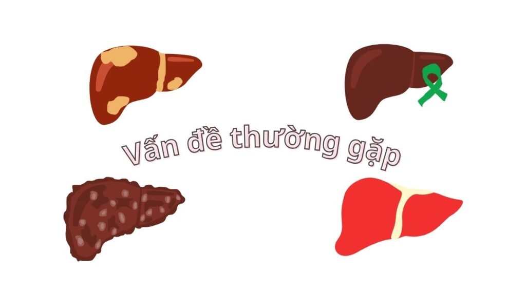 Nuôi dưỡng gan bằng dinh dưỡng chay