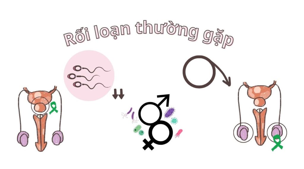 Mở bí mật hệ sinh sản nam