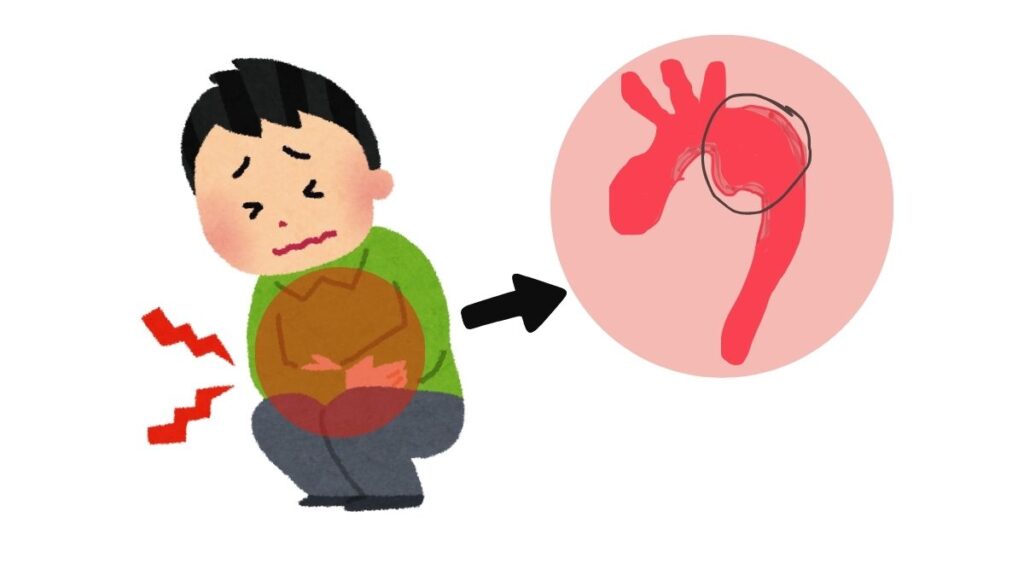 Giải pháp từ thực vật chữa lành phình động mạch bụng