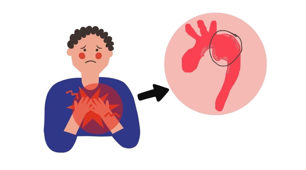 Dinh dưỡng chay là chìa khóa tự nhiên cho phình động mạch ngực
