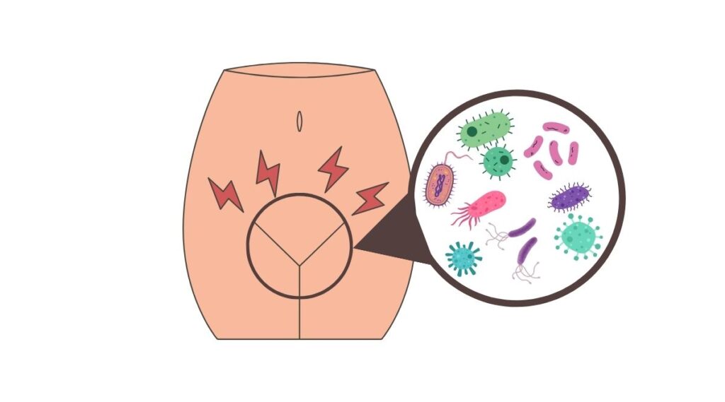 Bật mí bệnh Trichomonas
